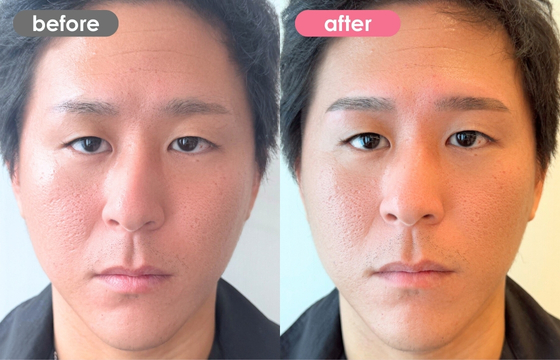 眉アートメイク(メンズ)31