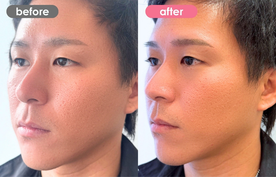 眉アートメイク(メンズ)31 03