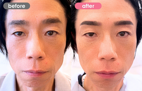 眉アートメイク(メンズ)32