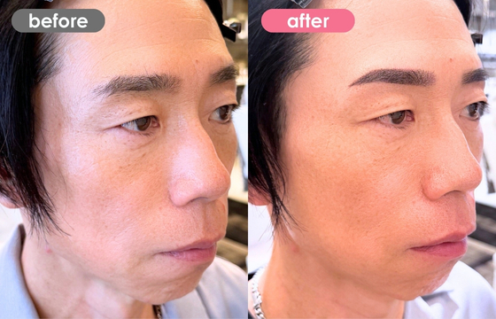 眉アートメイク(メンズ)32 02