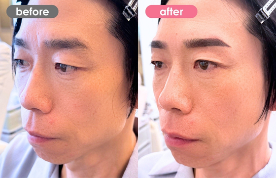 眉アートメイク(メンズ)32 03