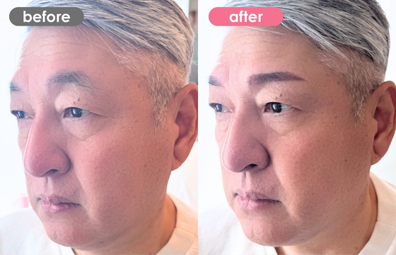 眉アートメイク(メンズ)33 02