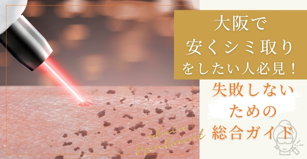 大阪で安くシミ取りをしたい人必見！失敗しないための総合ガイド