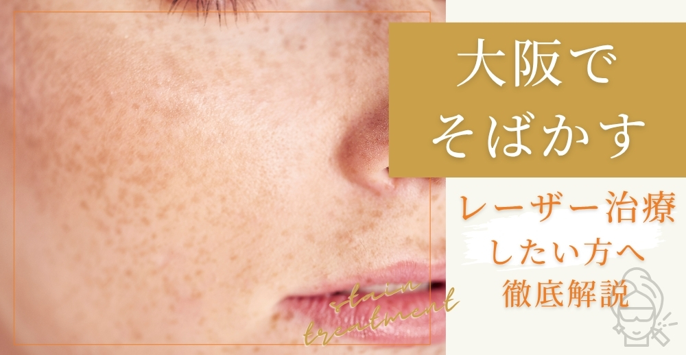 大阪でそばかすをレーザー治療したい方へ徹底解説