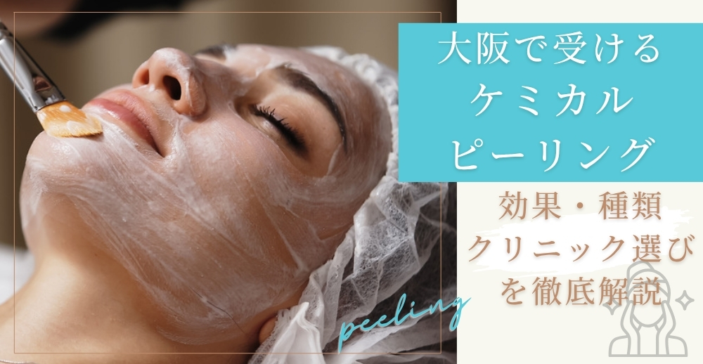 大阪で受けるケミカルピーリングのすべて：効果・種類・クリニック選びを徹底解説