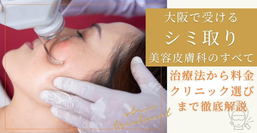 大阪で受けるシミ取り・美容皮膚科のすべて：治療法から料金、クリニック選びまで徹底解説
