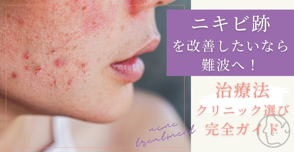 ニキビ跡を改善したいなら難波へ！治療法・クリニック選び完全ガイド