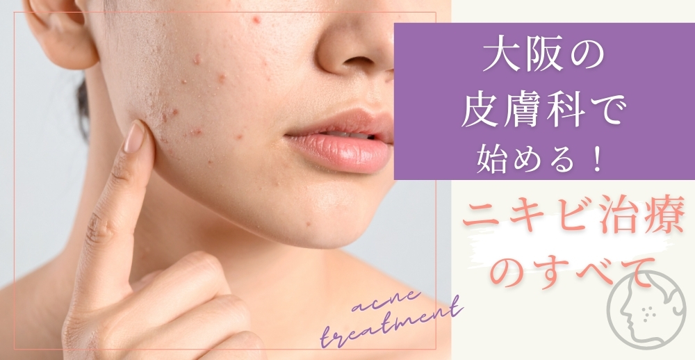 大阪の皮膚科で始める！ニキビ治療のすべて