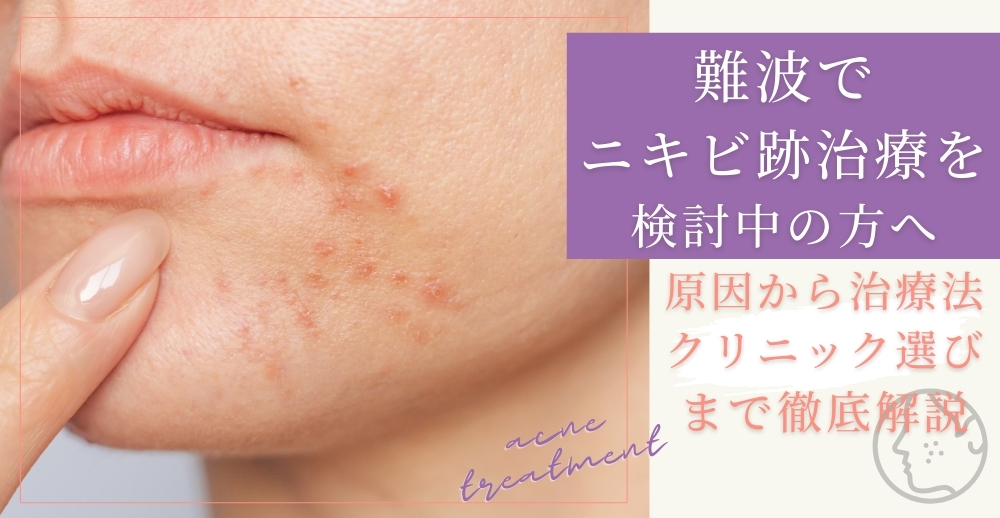 難波でニキビ跡治療を検討中の方へ：原因から治療法、クリニック選びまで徹底解説