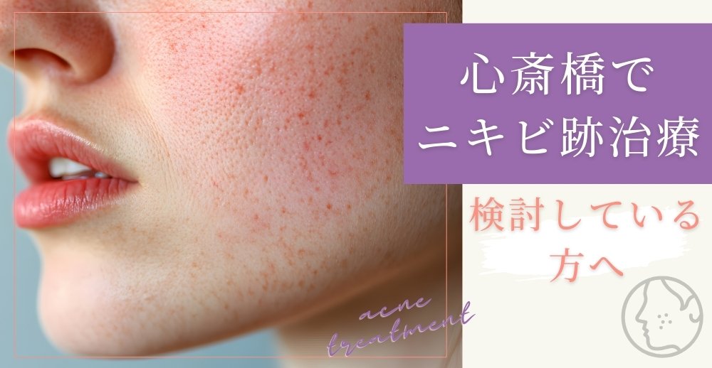 心斎橋でニキビ跡治療を検討している方へ