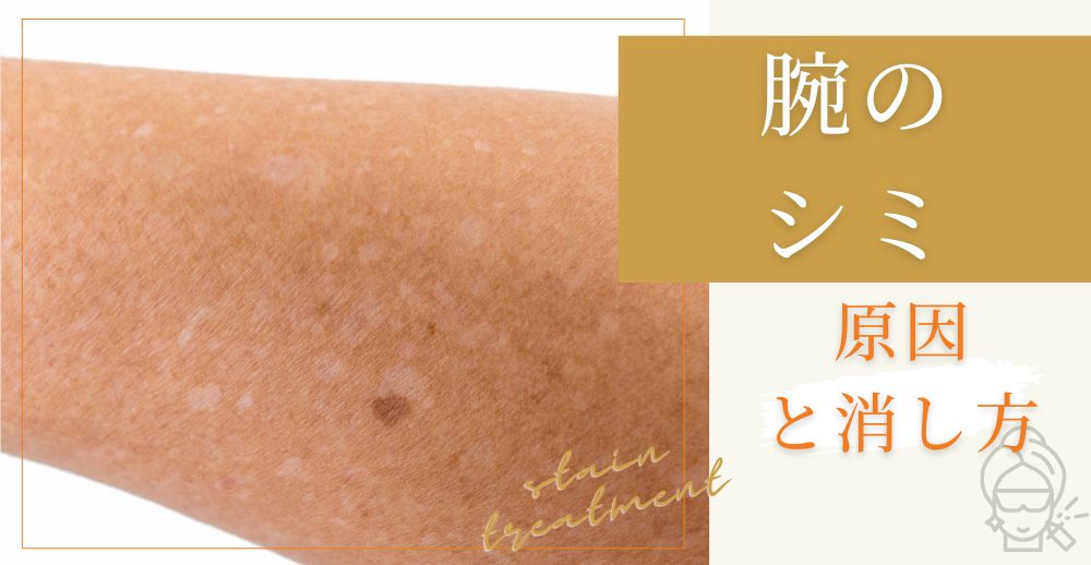 腕のシミの原因と消し方