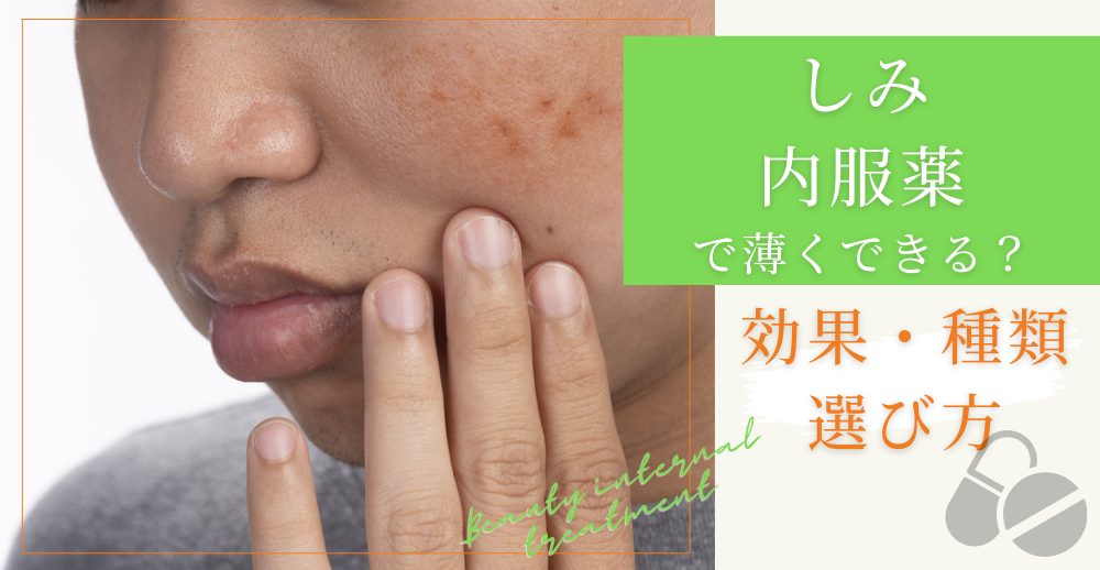 しみの内服薬で薄くできる？効果・種類・選び方