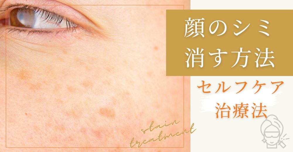 顔のシミを消す方法｜セルフケア・化粧品・美容皮膚科治療を種類別に解説