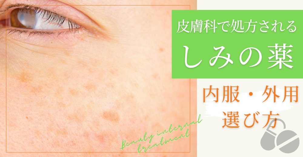 皮膚科で処方される「しみの薬」内服・外用・選び方