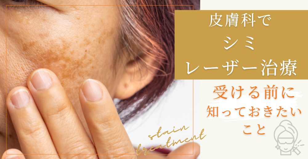 シミを皮膚科でレーザー治療する前に知っておくこと