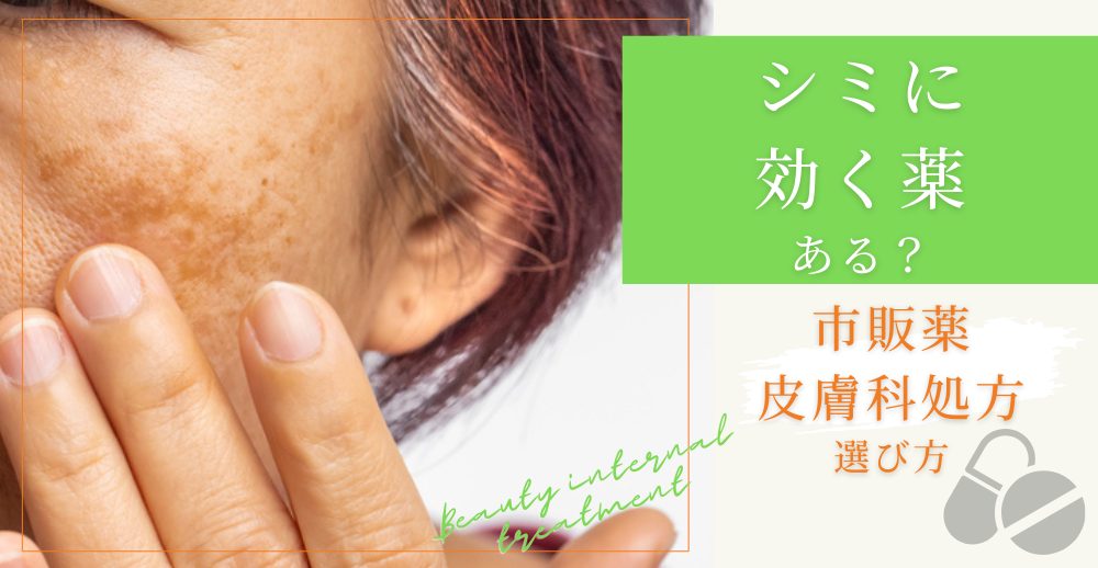 シミに効く薬はある？市販薬と皮膚科処方の選び方