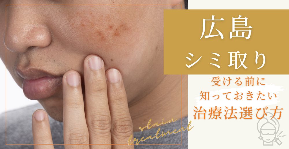 広島でシミ取りを受ける前に知っておきたい治療法・選び方