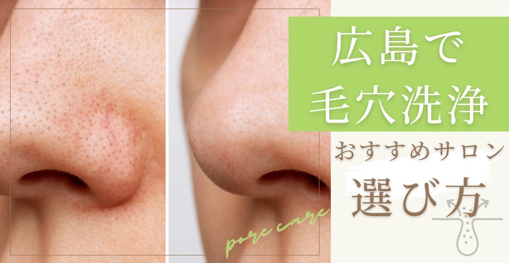 広島で毛穴洗浄ができるおすすめサロンの選び方