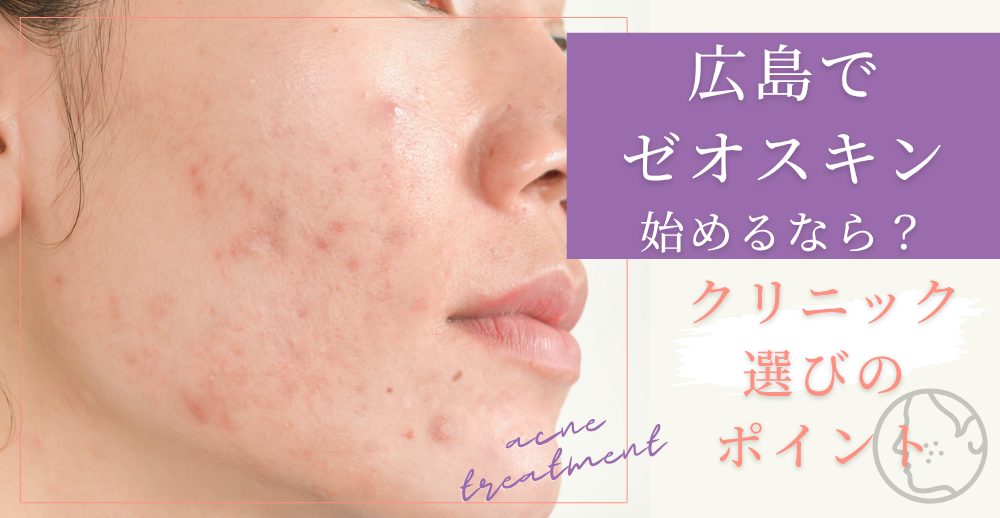 ゼオスキンを広島で始めるなら？クリニック選びのポイント