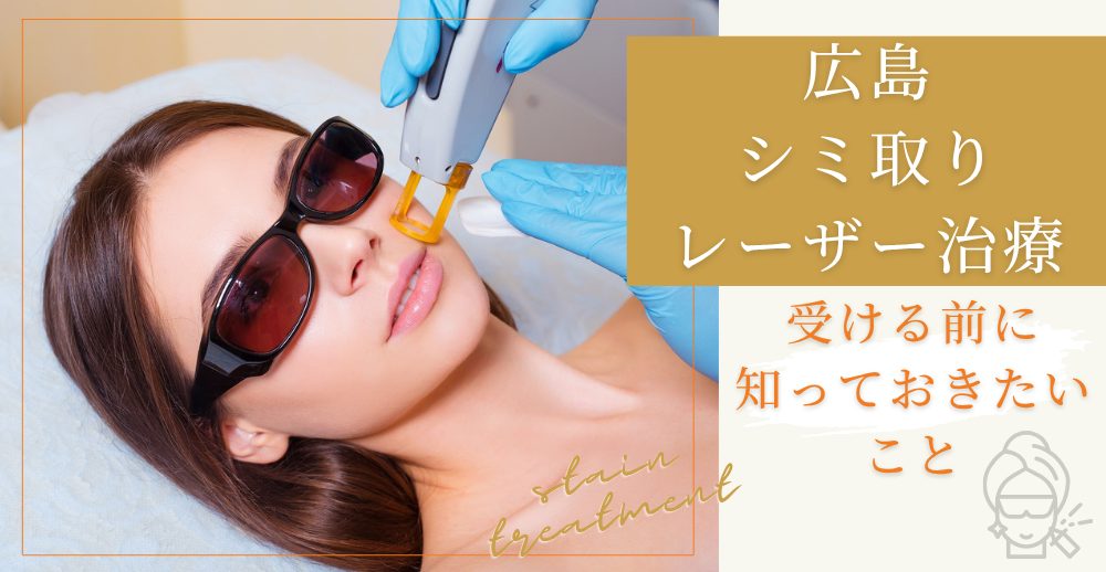 広島でシミ取りレーザーを受ける前に知っておきたいこと
